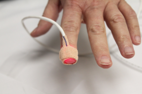 自动测量夜间血氧含量可以加快对儿童睡眠呼吸暂停的诊断