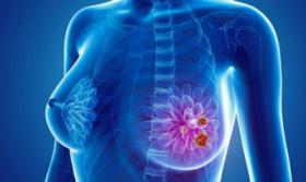 2018年4月26-28日（芝加哥）芝加哥乳腺研讨会及第7届世界淋巴水肿外科研讨会