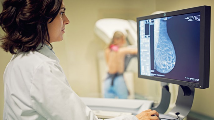 致密性乳腺和乳腺癌：每个女性都需要知道的事