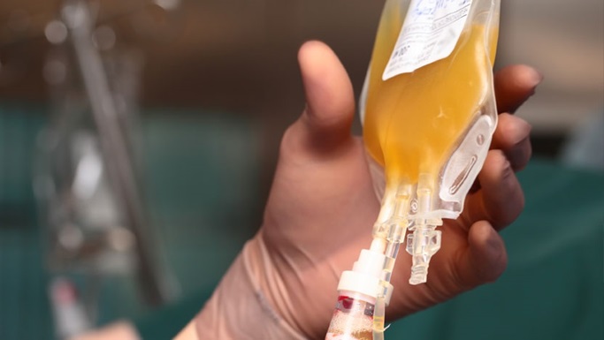 芝加哥大学医学中心开始为冠状病毒患者输注恢复期血浆的探索性临床试验