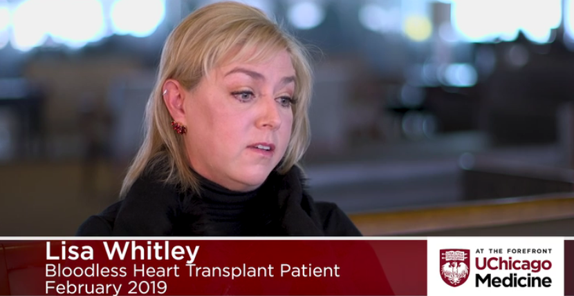 巨细胞性心肌炎女性患者接受无血心脏移植