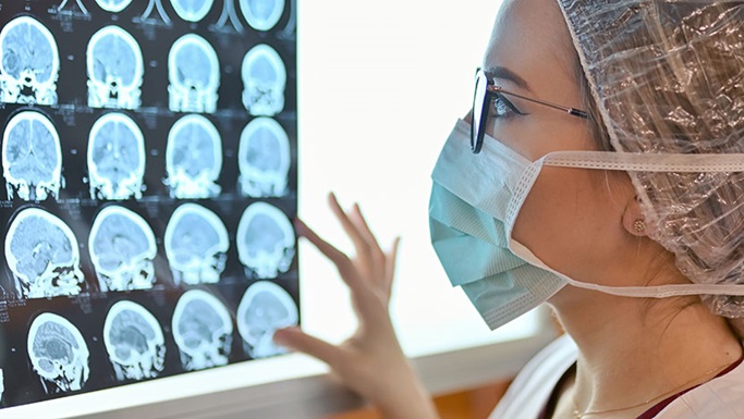 脑癌的注意事项及其他常见问题解答